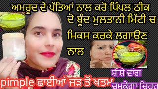 💯pimple ਦਾਗ ਛਾਈਆਂ ਠੀਕ ਕਰਨ ਲਈ ਅਮਰੂਦ ਦੇ ਰਸ ਵਿੱਚ ਮੁਲਤਾਨੀ ਮਿੱਟੀ ਲਗਾ ਕੇ ਚਿਹਰਾ ਚਮਕਾਓ ਸ਼ੀਸ਼ੇ ਵਾਂਗ