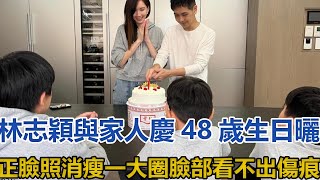 林志穎與家人慶48歲生日，曬正臉照消瘦一大圈，臉部看不出傷痕#林志穎