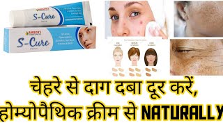 Bakson's S Cure Cream Benefits, Uses, Review, Appication | दाग दभे दूर करने की homeopathic cream