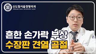 흔한 손가락 부상! 수장판 견열 골절