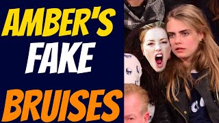 AMBER'S WOUNDS WERE FAKE - Amber Heard's Friend Reveals SHE FAKED Bruises | Celebrity Craze
