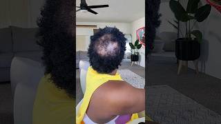 Style my NEW Big Chop with me! Natural TWA Thin Hairloss from PCOS