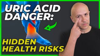 High Uric Acid? Take Control with These Science-Backed Strategies | How To Deal With GOUT?