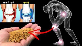 100 साल तक Calcium की कमी नही होने देता, जोड़, कमर दर्द अब और नही, कमजोर हड्डियों को फौलाद बना देगा