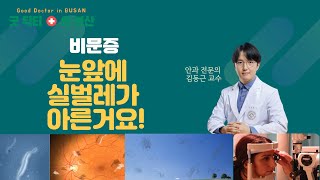 눈앞에 실벌레가 아른거려요? 비문증 방치하면 안돼요.  [김동근 안과 전문의 - MBC 건강교실 23.1.12.]