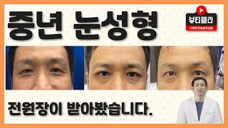 중년 쌍꺼풀 눈성형, 전원장이 대신 받아봤습니다.(중년 버전)