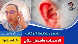 عظمة الركاب وسماعات الأذن | اهلا يا دكتور تيبس عظمة الركاب و ضعف السمع امراض الأنف والأذن والحنجرة