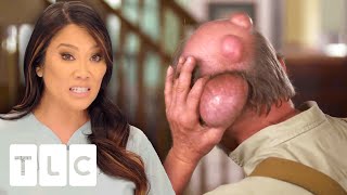 Dr. Lee Removes 4 ENORMOUS Cysts In 2 Separate Surgeries I Dr. Pimple Popper: Pop Ups