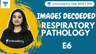 IMAGES DECODED | EPS 6 | RESPIRATORY PATHOLOGY | MUST KNOW IMAGES IN PATHOLOGY | DR. PREETI SHARMA