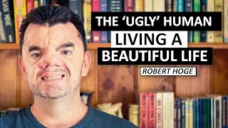 Meet Robert Hoge, the ‘Ugly’ Human Living a Beautiful Life