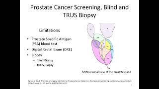 “Computer-aided diagnosis of prostate cancer using multi-parametric...”