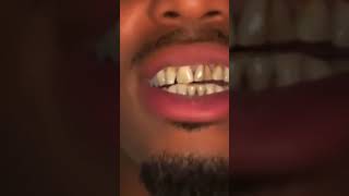Quavo shows his teeth without the grillz.