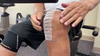 15-Days After a total knee replacement Day 1 of outpatient physical therapy. AMAZING!!! Part 1
