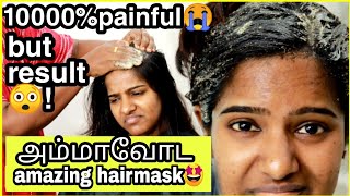 World's Most Painful DIY Hairmask for Dandruff,Dry\u0026itchy flaky scalp😲with English intructions!👇🏾