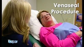 Venaseal Procedure