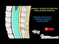 mnemonic for lumbar puncture spinal anesthesia layers