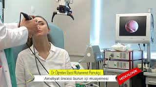 Burun ameliyatı öncesi burun içi muayenesi / Dr. Muhammet Pamukçu