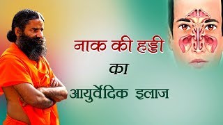 Ayurvedic treatment of nose bone. Swami Ramdev