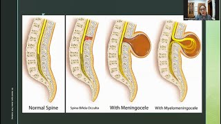 Development of the Nervous System- Part 2