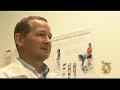 prosthetics career videos