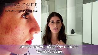 איך לטפל באקנה I אקנה טיפול טבעי באקנה I בשיטת רבקה זיידה - RIVKA ZAIDE