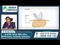 లివర్ డామేజ్ లక్షణాలు causes and symptoms of liver abscess in telugu sankhya hospitals