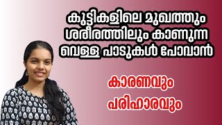 കുട്ടികളുടെ ശരീരത്തിലും മുഖത്തും കാണുന്ന വെള്ളപാടുകൾ പോവാൻ | White patches in children malayalam