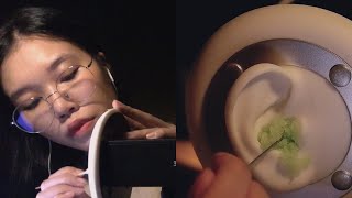 ASMR Intense Ear Cleaning / Ear Wax ขี้หูเยอะ ต้องแคะให้โล่ง