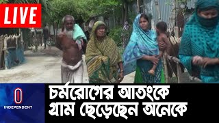 আক্রান্ত ব্যক্তি ও তার স্বজনদের কাজে না নেয়ায় কর্মহীন ও অনাহারে অনেকেই || Natore