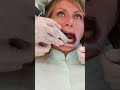 new virtuovivo intraoral scanner by straumann unboxing