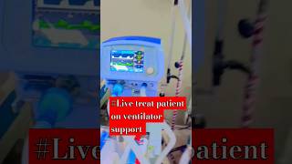 Live treat patient on ventilator support