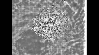 Proliferation of human lung carcinome cell line A549 printed on the glass slide