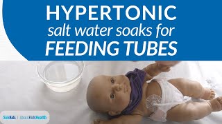 How to make and apply hypertonic salt water soaks | AboutKidsHealth at SickKids