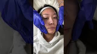 The Hydrafacial is my Winter skin rescue !! #hydrafacial #winterskin @PinnacleDermatology