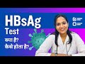 HBsAg Test Kya Hota Hai? HBsAg Test Result, Procedure, Positive & Negative