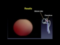 Pressure-controlled air-insufflated high-definition dacryoendoscopy – Video abstract ID 135234