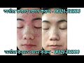 ^^fiorae tomato u0026 gluta plus soap review benefit price how to use^^