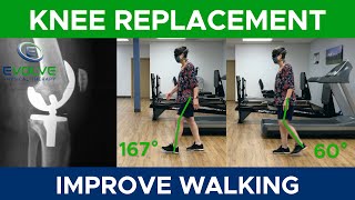 Total Knee Replacement | Improve Walking With Strobe Eyewear | Part 1