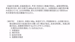 看護師国家試験過去問｜95回午後76-78｜吉田ゼミナール