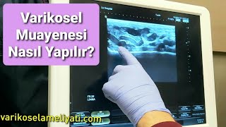 Varikosel Muayenesi Nasıl Yapılır? Varikosel Teşhisi Renkli Doppler Eşliğinde Nasıl Konur?