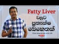 Fatty Liver වලට ප්‍රත්‍යක්ෂ බෙහෙතක්  | Tissa Jananayake with Life (EP 96)