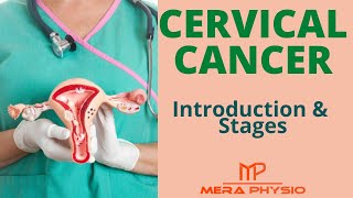Cervical Cancer | Introduction & Stages of Cervical Cancer | In Hindi | Mera Physio