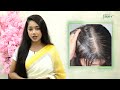 নতুন চুল গজাতে পেঁয়াজের রস কতোটা কার্যকরী onion juice for hair growth onion juice