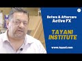 Before and After Active FX / Ophthalmology | Tayani Institute