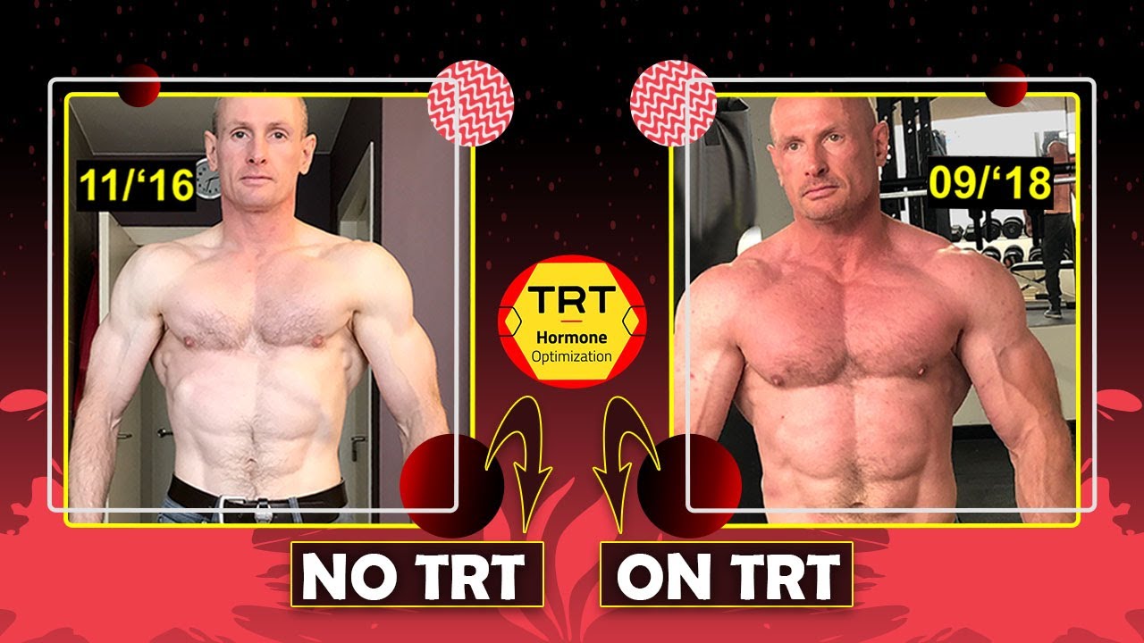 Does TRT Build Muscle? - TRT And Muscle Growth - TRT Before And After ...