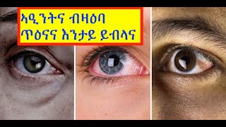 ኣዒንትናን ሓፈሻዊ ጥዕናናን (Our eyes and our Health)