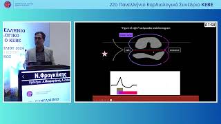 Ν. Φραγκάκης | Σύγχρονες τεχνικές χαρτογραφήσεων κοιλιακών ταχυκαρδιών