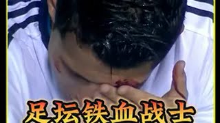 “持续6分钟的无麻钢针穿刺！足坛铁血战士C罗演绎极致拼搏精神”c罗 巅峰c罗 皇马 足球 dou来足球季