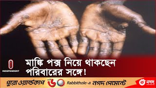 সৌদি ফেরত ৭ প্রবাসী মাঙ্কি পক্সে আক্রান্ত হলেও হয়নি স্বাস্থ্য পরীক্ষা || Monkey Pox | Independent TV