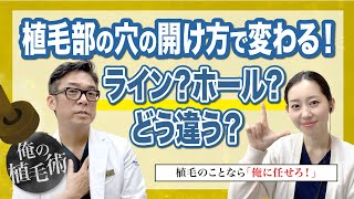 【俺の植毛術】ラインorホール？〜生え際を自然で美しく見せる植毛のために〜【自毛植毛】